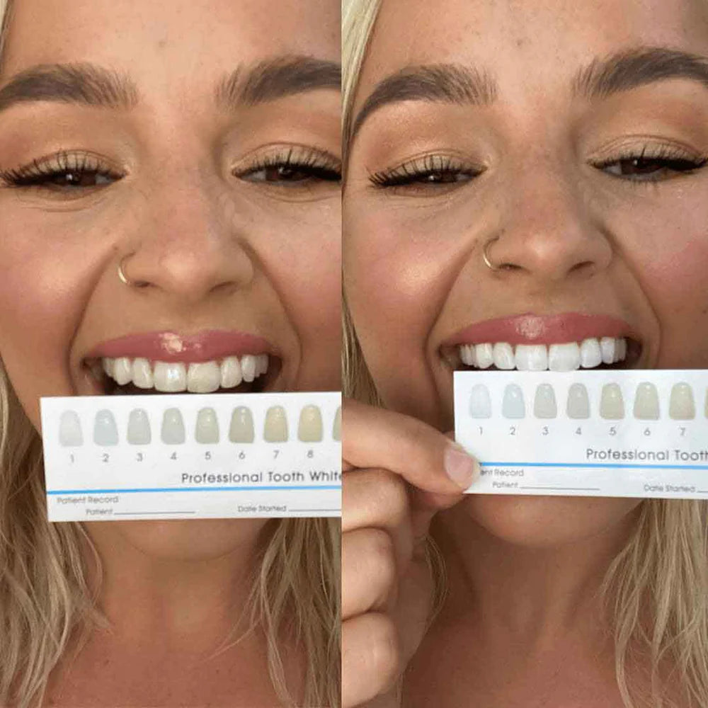 Snouwhite Whitening Pen
